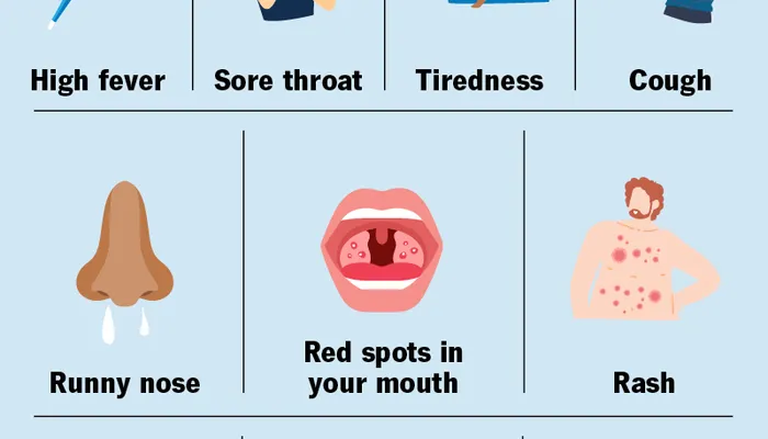 Measles Outbreak Maryland: Symptoms and More You Need To Know 